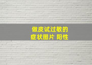 做皮试过敏的症状图片 阳性